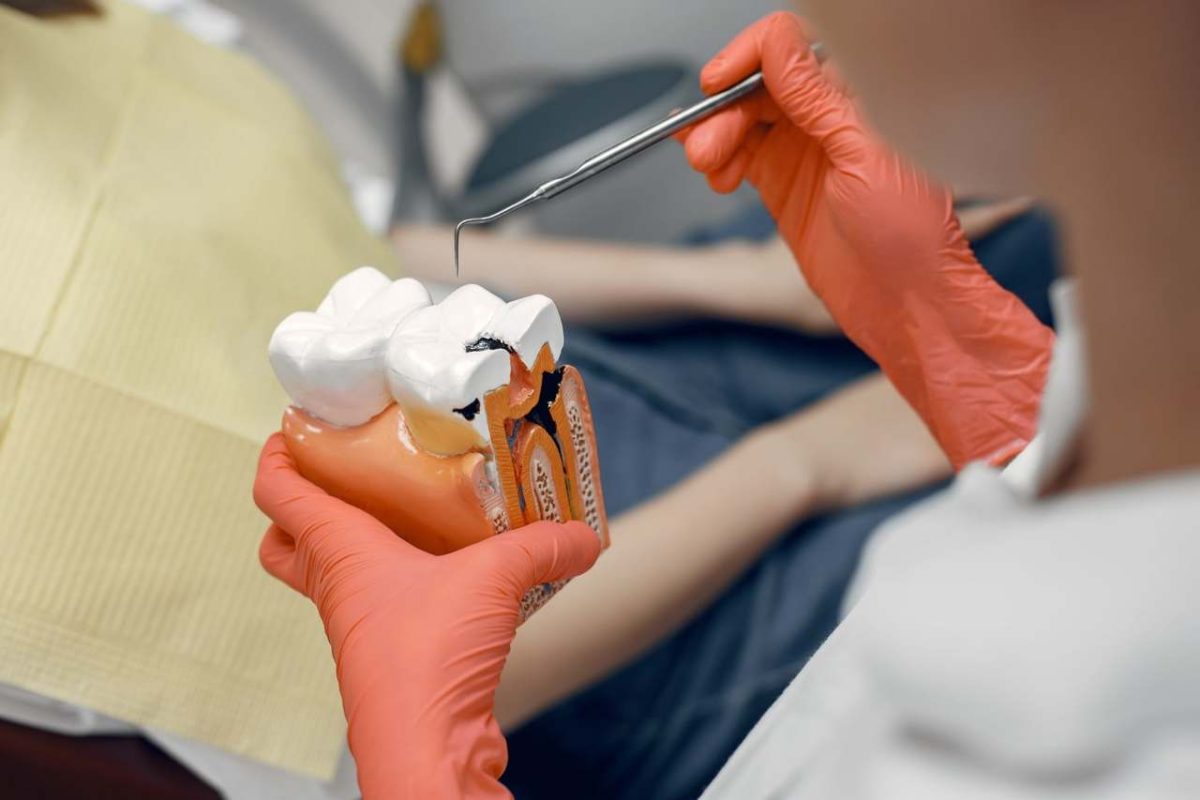 Qual é o melhor tipo de Prótese Dentária? 